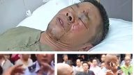 武汉城管打伤六旬残疾店主 官方诡辩称天热脾气大