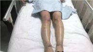 驚！粵2女疑家中瓦斯洩漏 點火測試引發爆炸