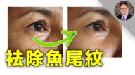 【四維健康】怎樣用自然方法消除魚尾紋？