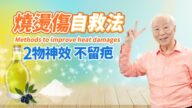 【胡乃文】烧烫伤自救法 2物奇效 不留疤痕